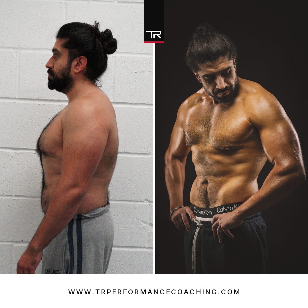 Dr Ajit Singh Hunjan — side, before and after