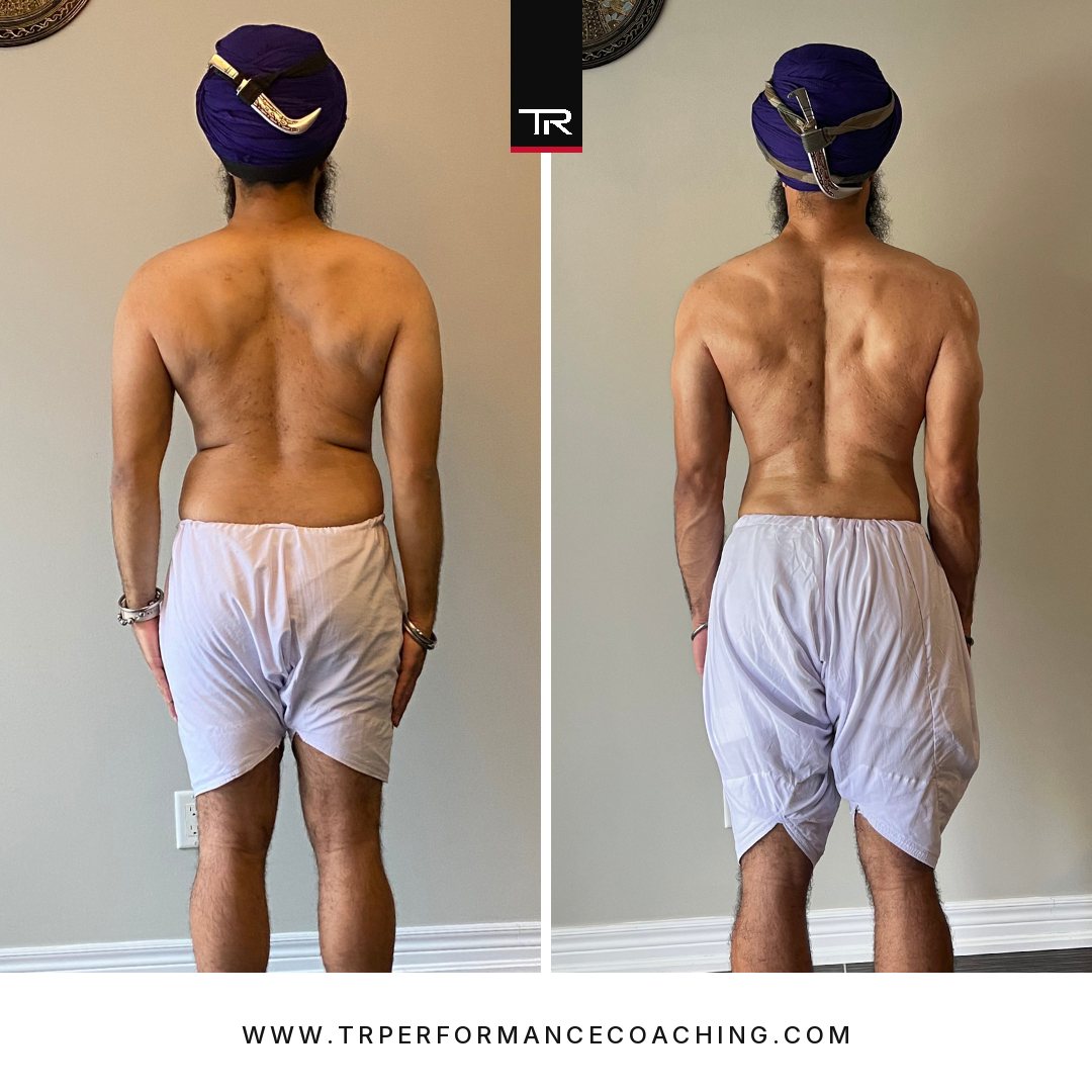 Koer Singh — back, before and after