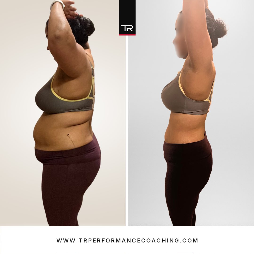 Mrs Kaur before and after, side profile