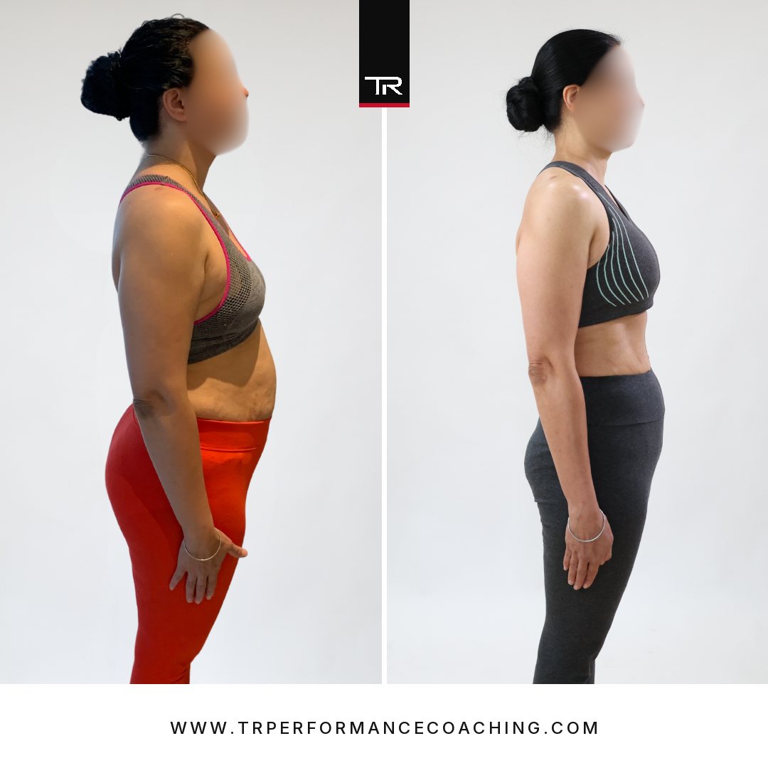 Rani Kaur — side profile, before and after